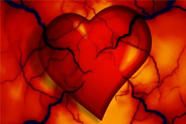What does it mean to dream about arteries? What does it mean to dream about arteries?