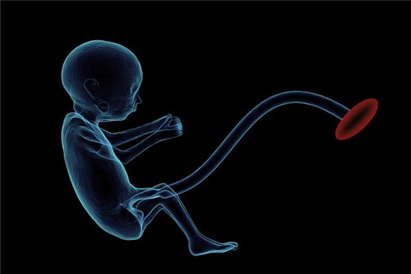What does it mean to dream about the umbilical cord? What does it mean to dream about the umbilical cord?