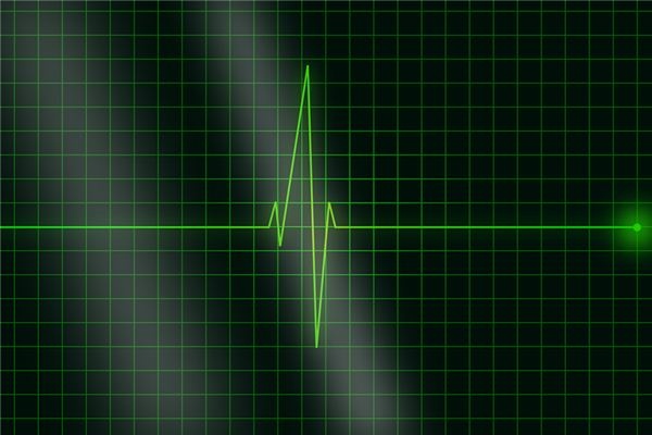 What does it mean to dream about a pulse? What does it mean to dream about a pulse?