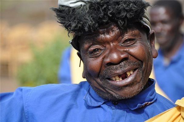 What does it mean to dream of teeth turning black? What does it mean to dream of teeth turning black?