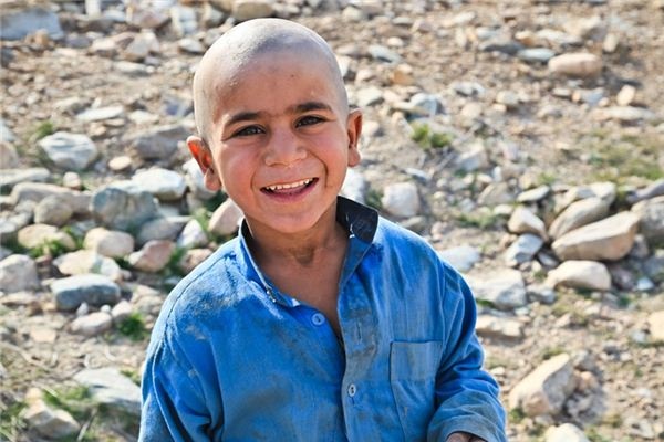 What does it mean to dream of being bald? What does it mean to dream of being bald?