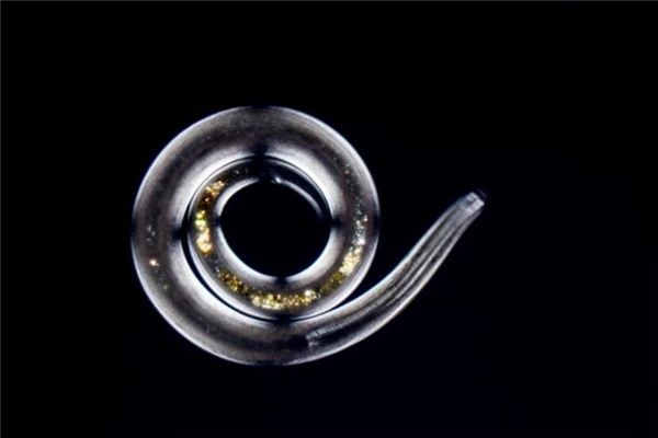 What does it mean to dream of roundworms? What does it mean to dream of roundworms?