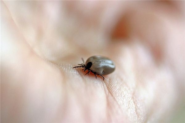 What does it mean to dream about parasites? What does it mean to dream about parasites?