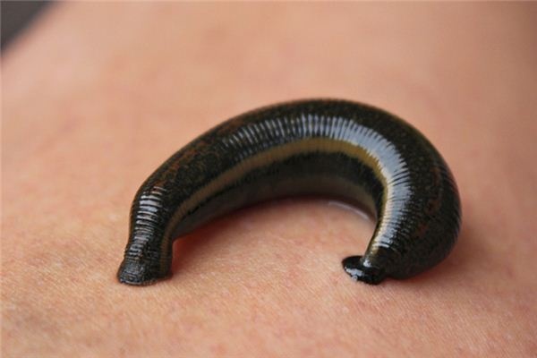 What does it mean to dream of being bitten by leeches? What does it mean to dream of being bitten by leeches?