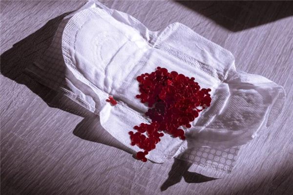 What does it mean to dream about sanitary napkins? What does it mean to dream about sanitary napkins?