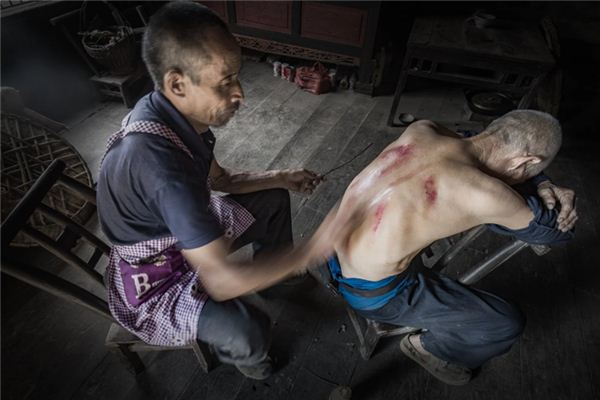 What does it mean to dream about gua sha? What does it mean to dream about gua sha?