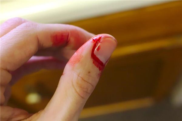 What does it mean to dream of pus and blood? What does it mean to dream of pus and blood?