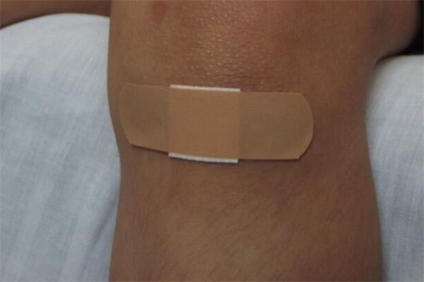 What does it mean to dream of wounds? What does it mean to dream of wounds?