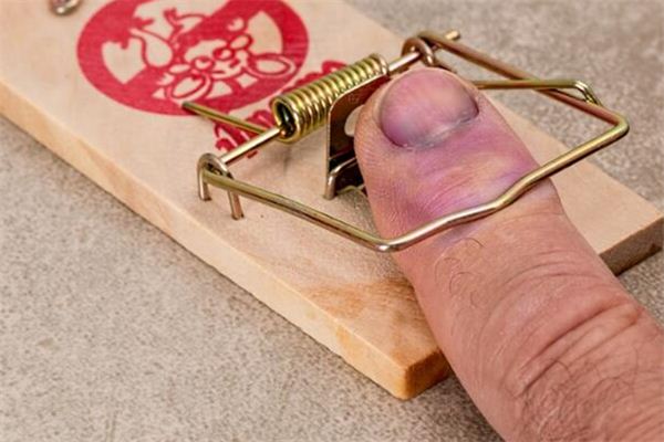 What does it mean to dream of swollen hands? What does it mean to dream of swollen hands?