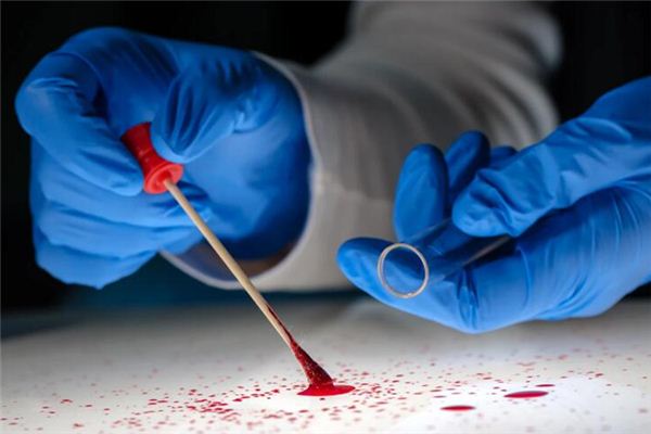 What does it mean to dream of urinating blood? What does it mean to dream of urinating blood?