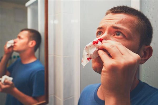 What does it mean to dream of nosebleeds? What does it mean to dream of nosebleeds?