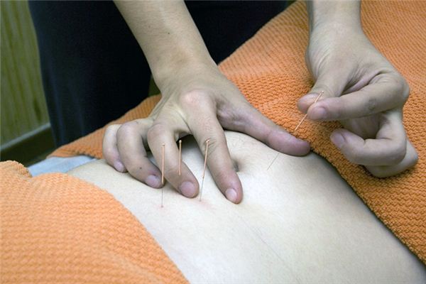 What does it mean to dream of acupuncture? What does it mean to dream of acupuncture?