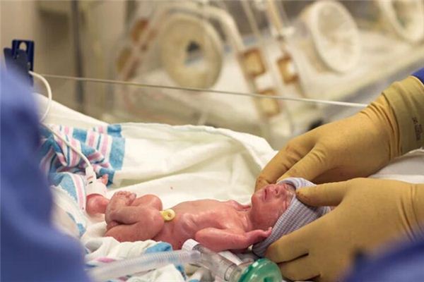 What does it mean to dream of your wife giving birth prematurely? What does it mean to dream of your wife giving birth prematurely?