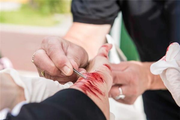 What does it mean to dream of bleeding from your arm? What does it mean to dream of bleeding from your arm?