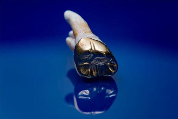 What does it mean to dream of having gold-plated teeth? What does it mean to dream of having gold-plated teeth?