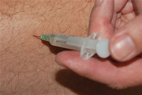 What does it mean to dream of getting acupuncture? What does it mean to dream of getting acupuncture?