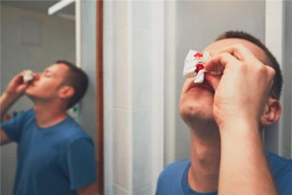What does it mean to dream of having a nosebleed? What does it mean to dream of having a nosebleed?