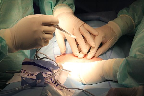 What does it mean to dream about surgery? What does it mean to dream about surgery?