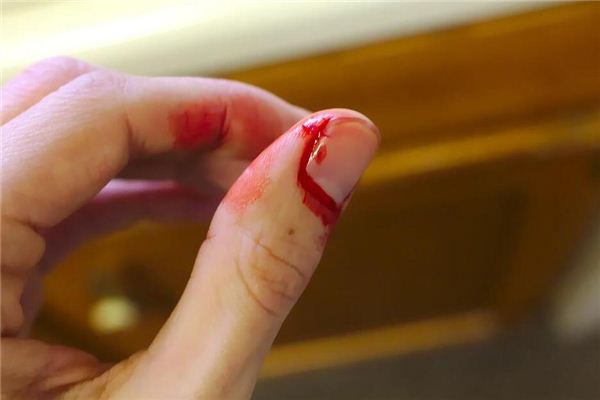 I dreamed that I cut my hand.