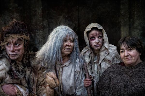 What does it mean to dream about leprosy? What does it mean to dream about leprosy?