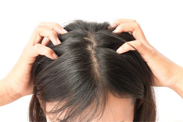 Dreaming of someone else having lice on their head
