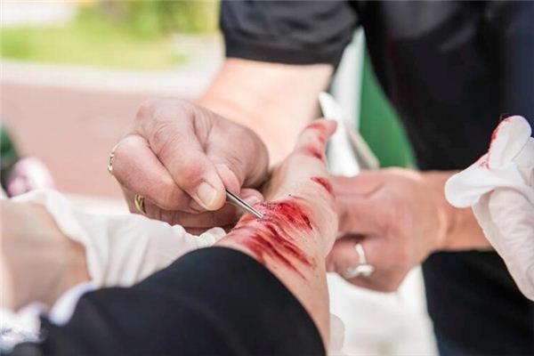What does it mean to dream of bleeding from your arm?